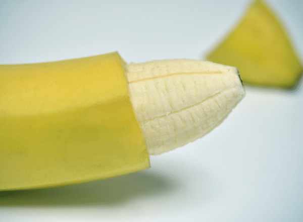 circumcision